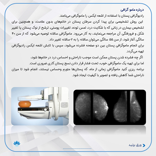 ماموگرافی